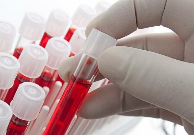 krevní test po požití alkoholu